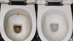 Non resterà più traccia delle fastidiose macchie gialle: ricordate questi 3 metodi per pulire il WC